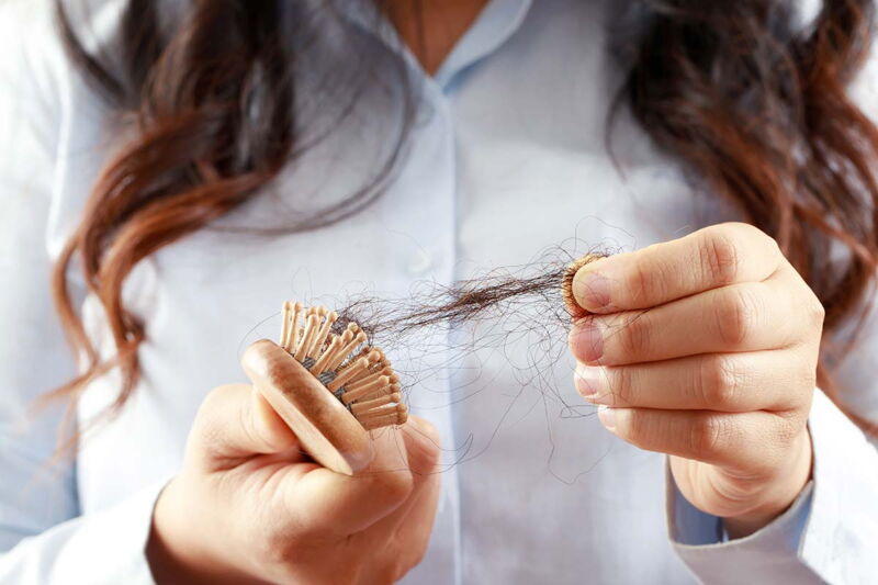 Haarausfall - Haare hängen in einer Bürste