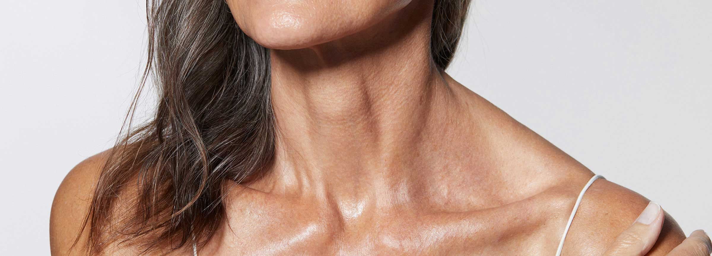 Entfernung von zur Pigmentflecken und Altersflecken in der ganzheitlichen Dermatologie Dr. med. Agata Jost Berlin