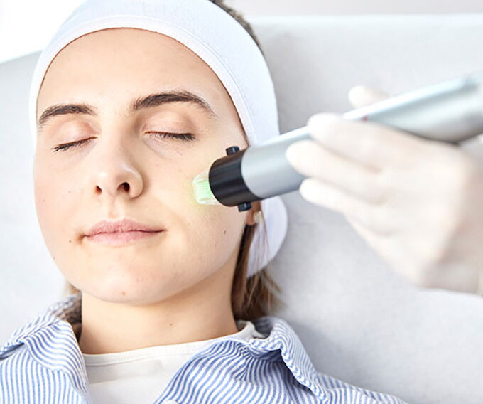 Patientin bekommt eine Radiofrequenz Microneedling Behandlung für ein junges Hautbild in Berlin Zehlendorf