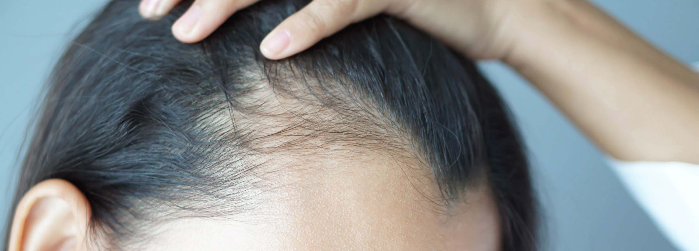 Haarausfall - eine Frau mit schwarzen Haaren