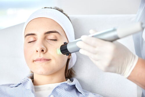 Gesichtsbehandlung mittels Laser