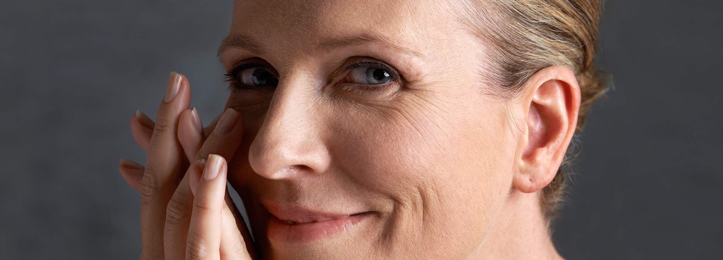 Frau nach Behandlung mit einer Fillerbehandlung mit Hyaluronsäure - Hyaluron, Hyaluronfiller, Volumenaufbau
