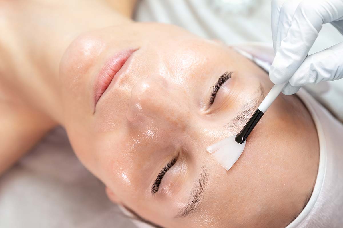 Fruchtsäurepeeling zur Behandlung von Narben, Akne, Falten, Altersflecken, große Poren, vorzeitige Haualterung