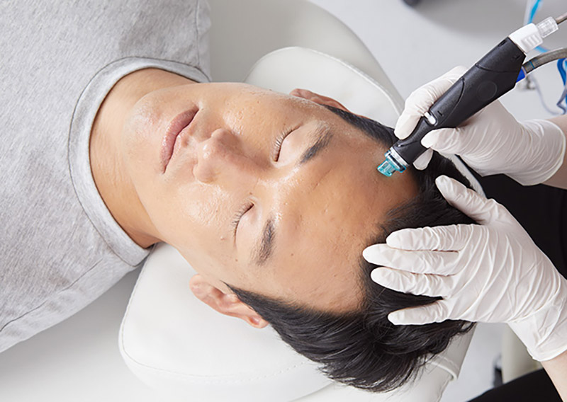 Patient bekommt eine Hydrafacial - Behandlung. Hautverjüngung - Glow